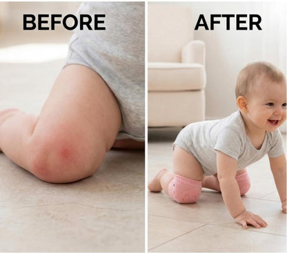 Baby 5-Pair Non-Slip Knee Pads, Thick Soft Contoured Fit for Crawling, Durable Fall Protection